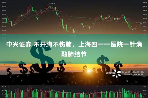 中兴证券 不开胸不伤肺,上海四一一医院一针消融肺结节